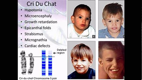 Chromosome Abnormalities List