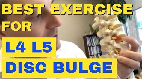 Best Exercise For L4 L5 Disc Bulge 4 Moves You Need To Know Dr