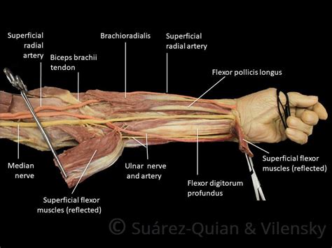Picture Of Forearm Tendons Tendons Forearm Anatomy