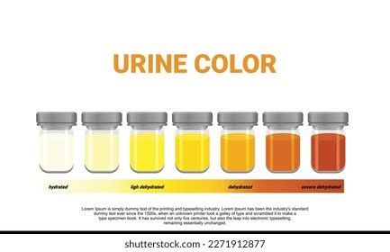 Illustration Urine Color Chart Stock Vector Royalty Free 2271912877