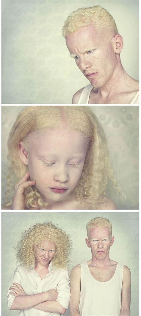 Gustavo Lacerda Albinos People Photos Portraits
