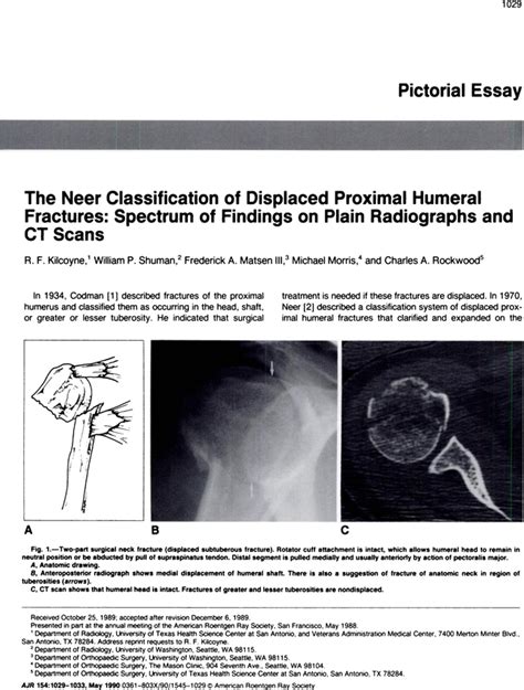 The Neer Classification Of Displaced Proximal Humeral Fractures