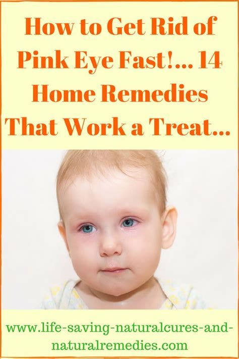 How To Get Rid Of Yellow Eyes In Newborns Teethwalls