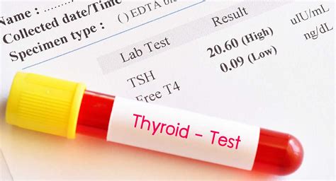 Specialize in histology, haematology and t urine test. Why you need a Thyroid Blood Test? -Biocity Healthcare