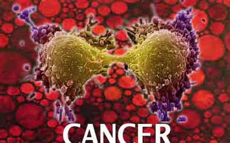 Cancer To Be A Major Disease In India Change In Lifestyle Main Culprit
