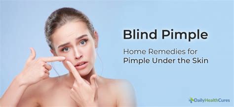 Blind Pimple 8 Home Remedies For Pimple Under The Skin