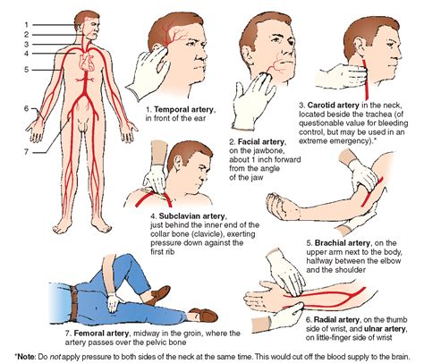 But most brain aneurysms don't cause any symptoms, and only a. The main arteries in the human body. Where pressure should ...