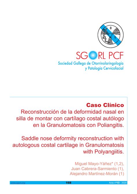 Pdf Saddle Nose Deformity Reconstruction With Autologous Costal