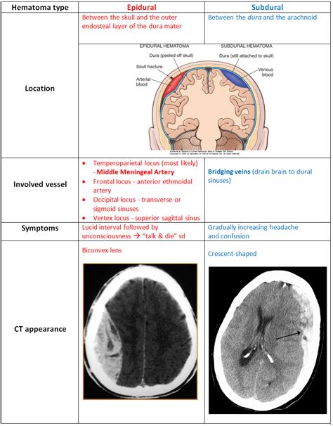 Symptoms of large and acute subdural hematoma. Pictures Of Subdural Hematoma And Epidural Hematoma ...