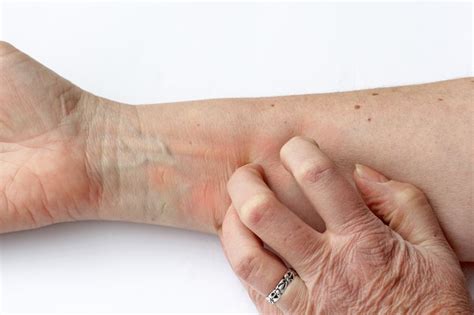 What Are The Causes Of Sudden Skin Itching Livestrongcom