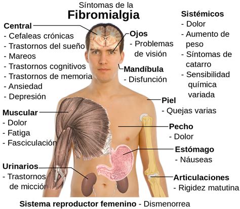 fibromialgia clínica tao salud