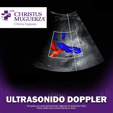 ULTRASONIDO DOPPLER Tienda Christus Muguerza
