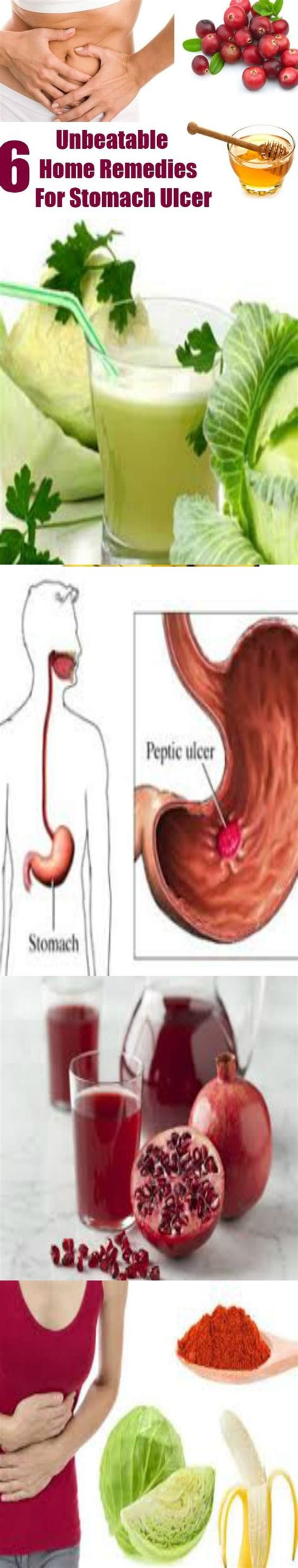 6 Unbeatable Home Remedies For Stomach Ulcer Stomach Ulcers Home