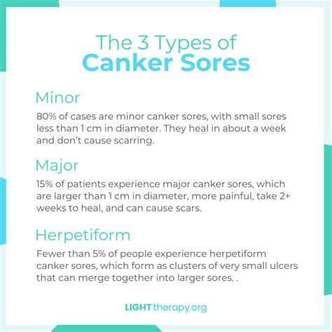 Canker Sores Light Therapy