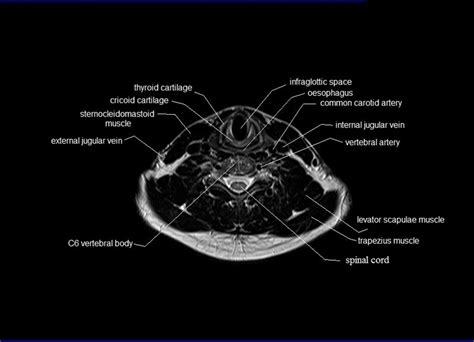 Mri Neck Anatomy