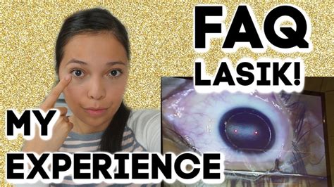 FAQ ABOUT LASIK EYE SURGERY MY LASIK EXPERIENCE YouTube