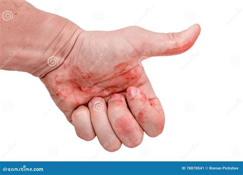 Like A Hand Stained In Blood On White Background Stock Image Image