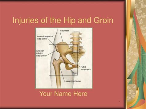 Ppt Injuries Of The Hip And Groin Powerpoint Presentation Free