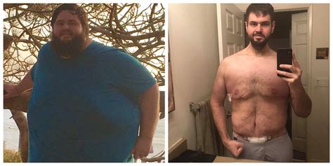 Man Loses Lbs Has To Have Surgery To Remove Lbs Of Extra Skin Fitness Volt