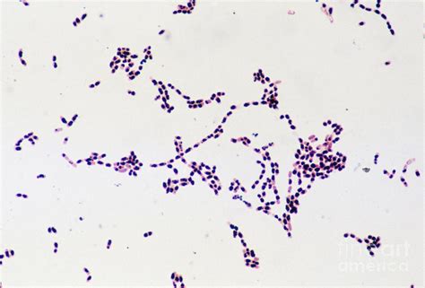 Lm Of Colony Of Bacillus Cereus Bacteria Photograph By John Durham