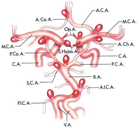 Most Common Sites Of Saccular Aneurysms Neuroanatomy The