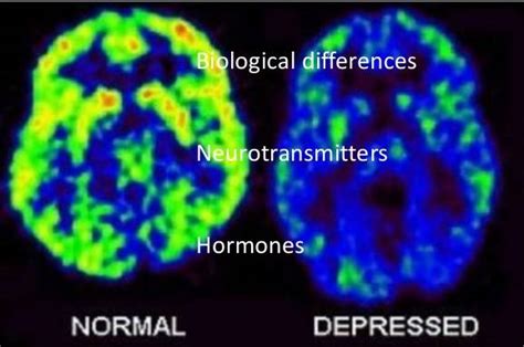 biological explanation ao1 ao2 psychology wizard