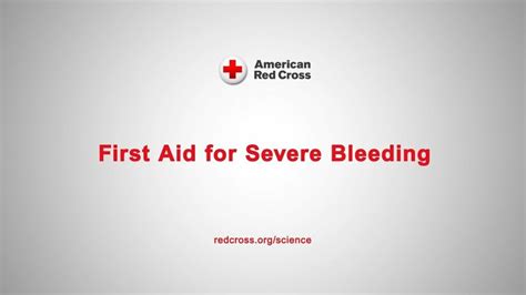 Help For Severe Bleeding Listen To From The Red Cross Scient