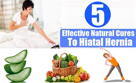 5 Effective Natural Cures For Hiatal Hernia Natural Treatment For
