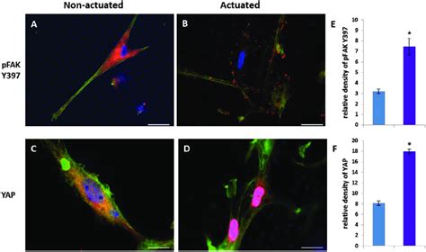 Indirect Immunofluorescence IIF Of Nonactuated And Actuated HMSCs