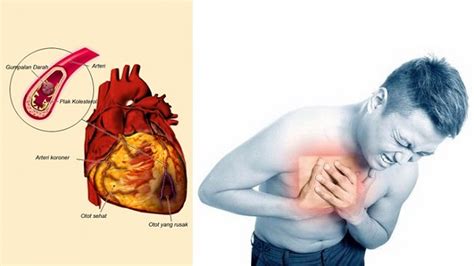6 tanda lemah jantung dan pencegahannya. WAJIB TAHU!! 8 Tanda-tanda Seseorang Itu Mengidap Penyakit ...