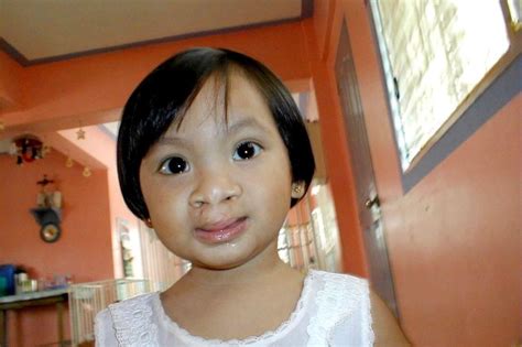 Free Cleft Surgery For 400 Filipino Children Globalgiving