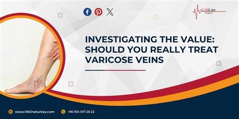 Investigating The Value Should You Really Treat Varicose Veins