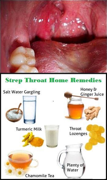 Home Cure For Strep Throat Mature Teen Tube
