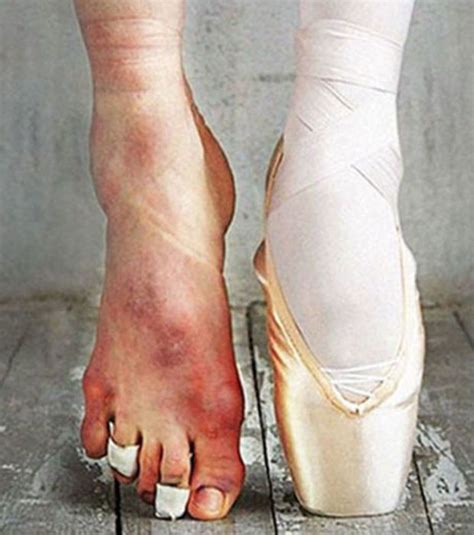 Lista 97 Imagen De Fondo Los Pies De Las Bailarinas De Ballet El último