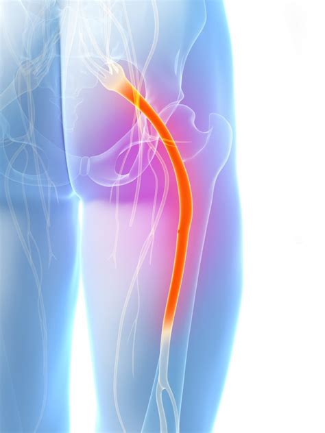 Pain In The Backside Dealing With Sciatic Nerve Pain Chiropractor