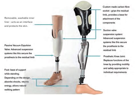 Key Parts Of Below And Above Knee Prostheses Download Scientific Diagram