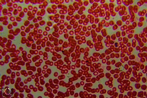 Under The Microscope Red Blood Cells Travis Hale Photography And