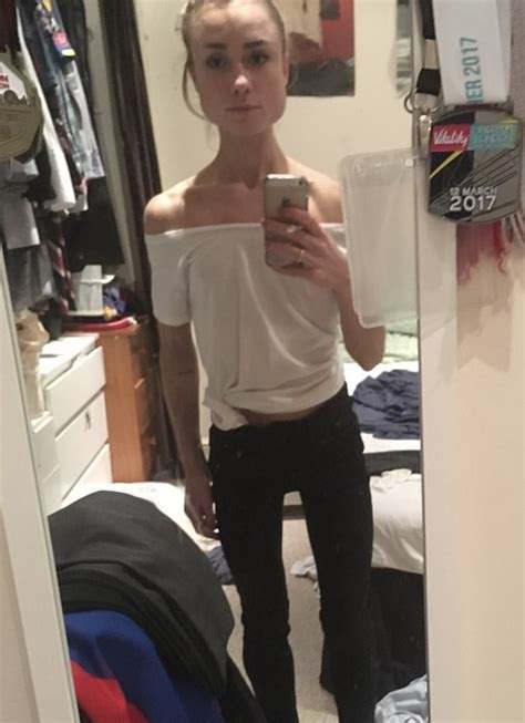 Anorexic Ballet Dancer Said Her Eating Disorder Made Her Dance 10 Hours