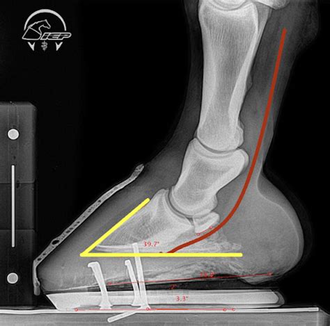 Mechanical Management Of Navicular Syndrome In Western Pleasure Horses
