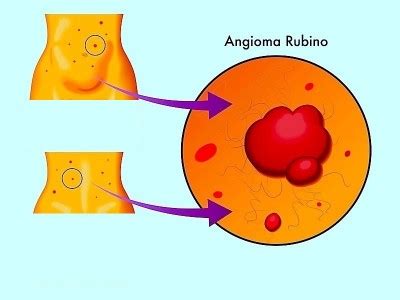 Macchie rosse sulla pelle del viso, gambe e sulla lingua ...