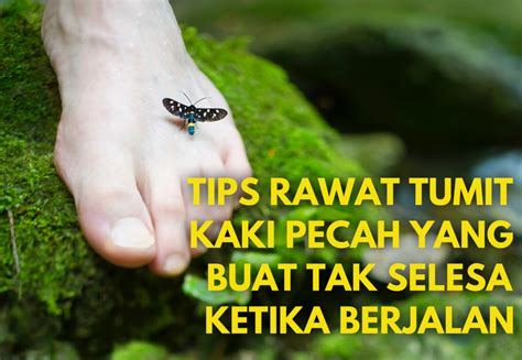 Kencana Asri Medika Tips Menjaga Kulit Telapak Kaki Agar Tidak Pecah Pecah