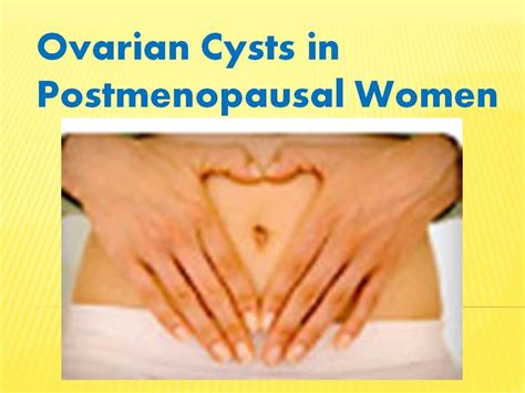 Ovarian Cysts In Postmenopausal Women Youtube