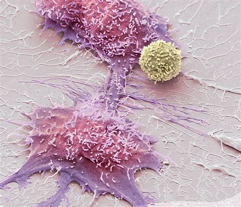 Natural Killer Cell And Cancer Cell Sem Stock Image C0492531