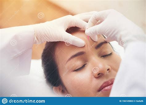 Relaxed Young Asian Woman Receiving Acupuncture Treatment In Beauty Spa Stock Image Image Of
