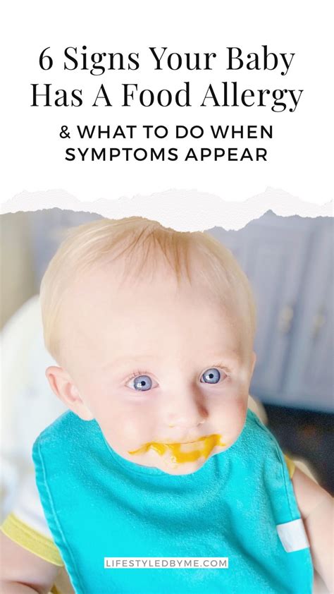 6 Signs Your Baby Has A Food Allergy Life Styled By Me Mom Blog