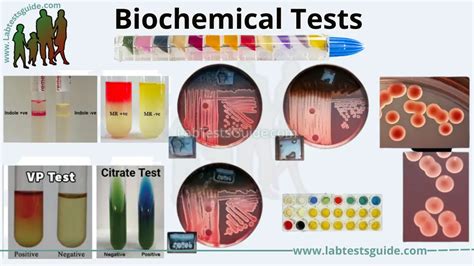Exploring Biochemical Tests Understanding Principles And Applications