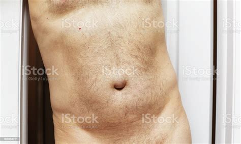 Male With Umbilical Hernia Stock Photo 181853211 Istock