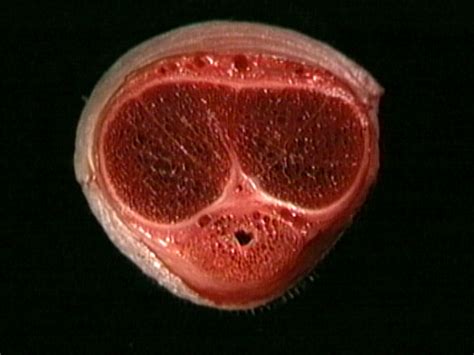 Cross section of the bone has circular shape ravely (see fig. Penis: distal part | Acland's Video Atlas of Human Anatomy