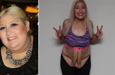 Diese Frau Verlor Fast 160 Kilo Und Zeigt Nun Anderen Wie Es Geht