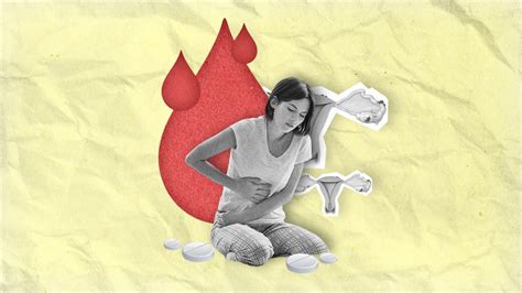 “el Dolor Es Real” Endometriosis Una Enfermedad “invisible” Que Afecta A Millones De Mujeres